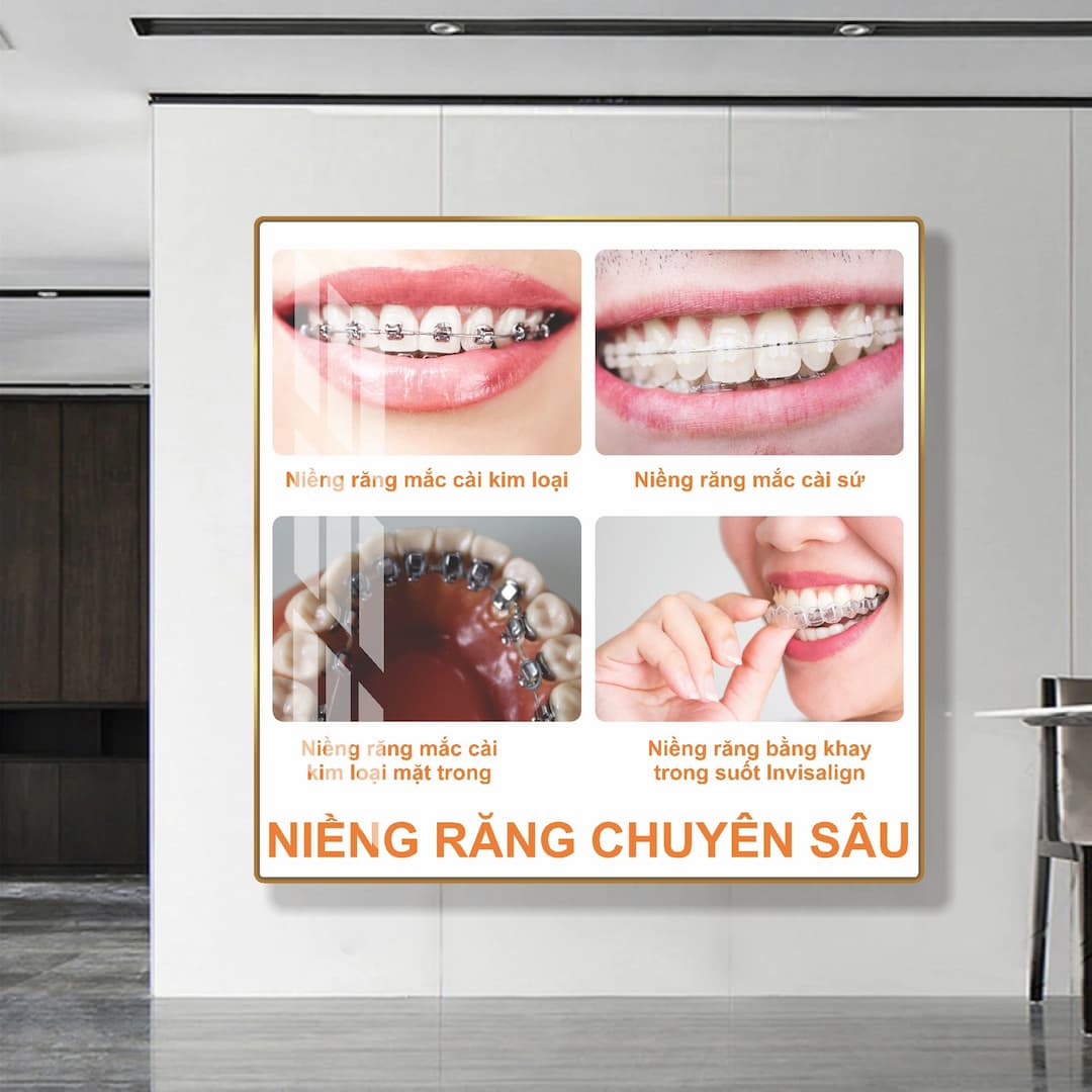 Tranh treo tường phòng răng nha khoa kỹ thuật niềng răng chuyên sâu 01