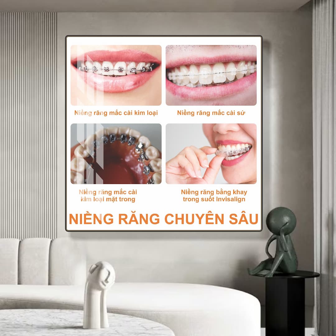 Tranh treo tường phòng răng nha khoa kỹ thuật niềng răng chuyên sâu 01