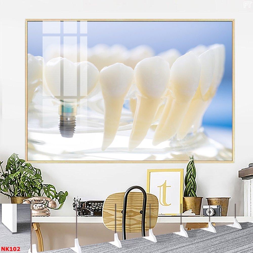 Tranh Treo Tường Nha Khoa Cấy Ghép IMPLANT 2